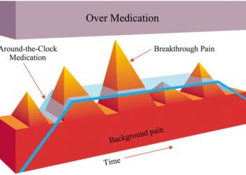Cancer Pain Management, Cancer-Related Breakthrough Pain, Therapy |  SpringerLink