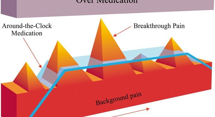 Cancer Pain Management, Cancer-Related Breakthrough Pain, Therapy |  SpringerLink