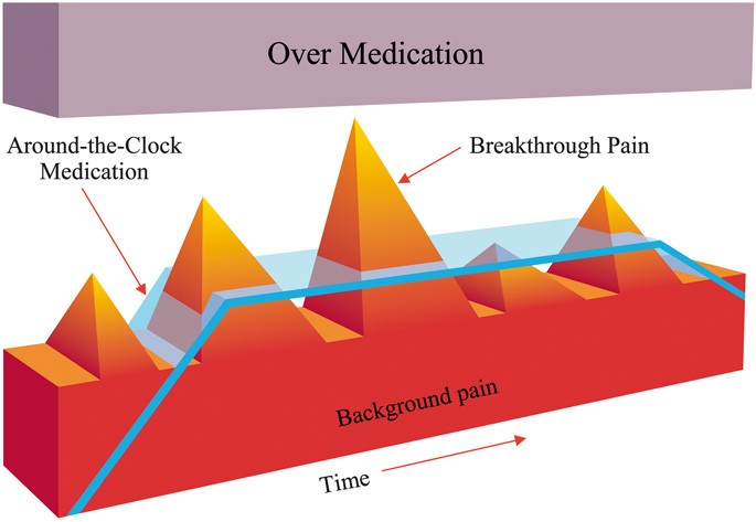 Cancer Pain Management, Cancer-Related Breakthrough Pain, Therapy | SpringerLink