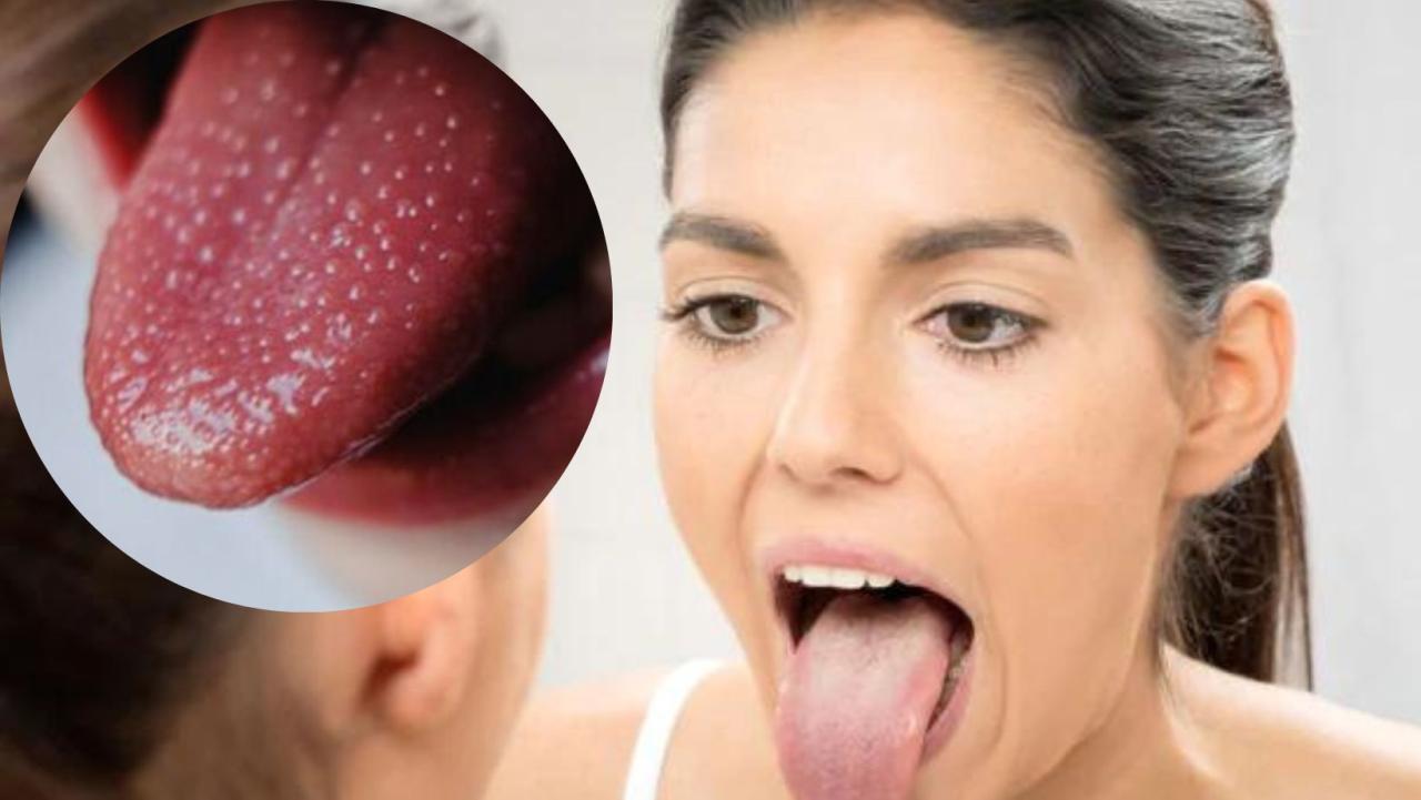 Vitamin B12 Deficiency: Silent Signs And Symptoms You Must Never Ignore |  TheHealthSite.com